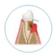 Icon zeigt Querschnitt von Zahn mit Zahnfleisch - Knochens und des Zahnhalteapparates